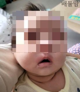 입 주변이 빨개진 아기 사진.