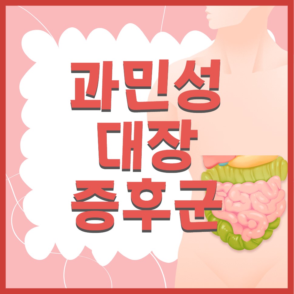 과민성-대장증후군-증상