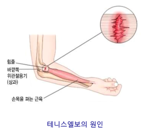 출처 : 선수촌병원