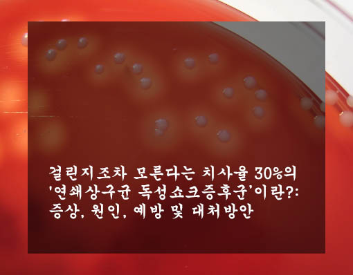  걸린지조차 모른다는 치사율 30%의 '연쇄상구균 독성쇼크증후군’이란?: 증상, 원인, 예방 및 대처방안
