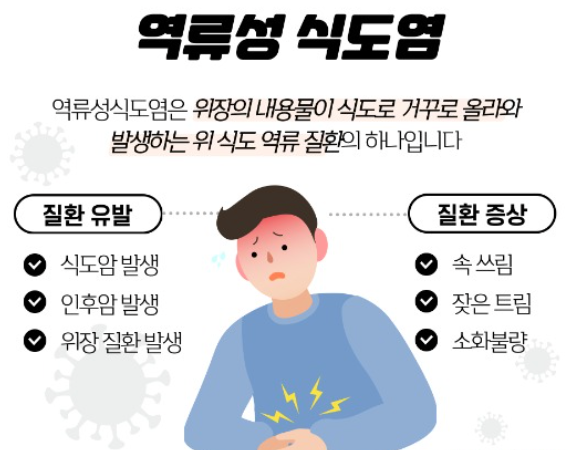 목에서신물식도염2