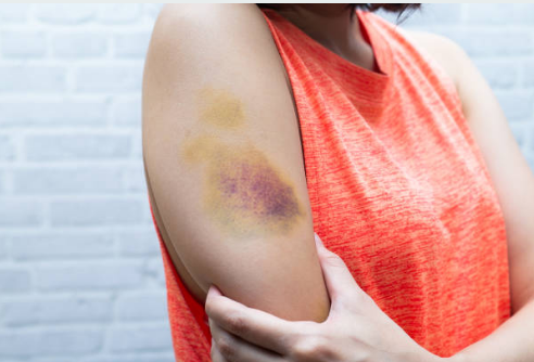 teen abuse evidence