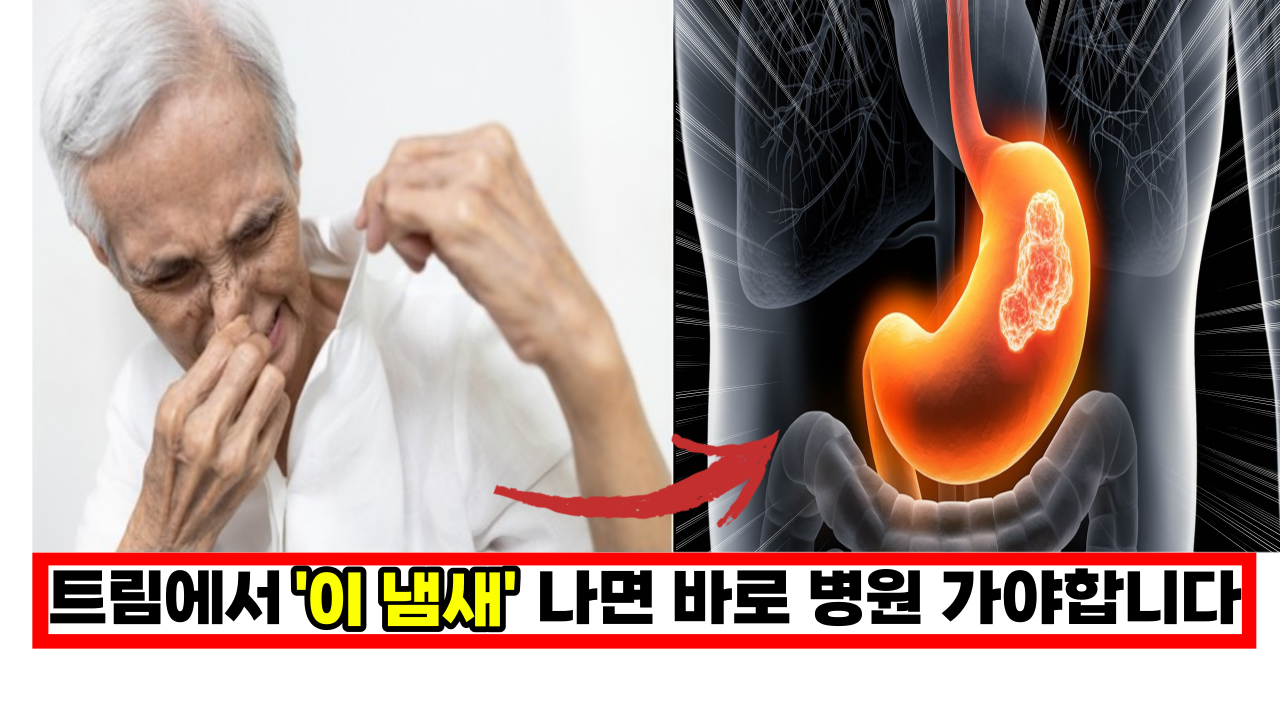  진짜 몰랐던 위암 신호, 트림에서 '이 냄새' 나면 바로 병원 가셔야 합니다.