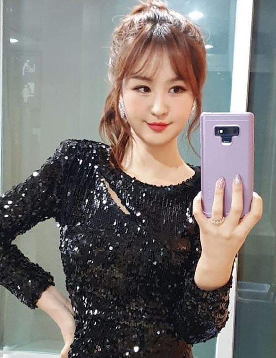  트로트가수 윤수현 성형 및 과거얼굴 몸매