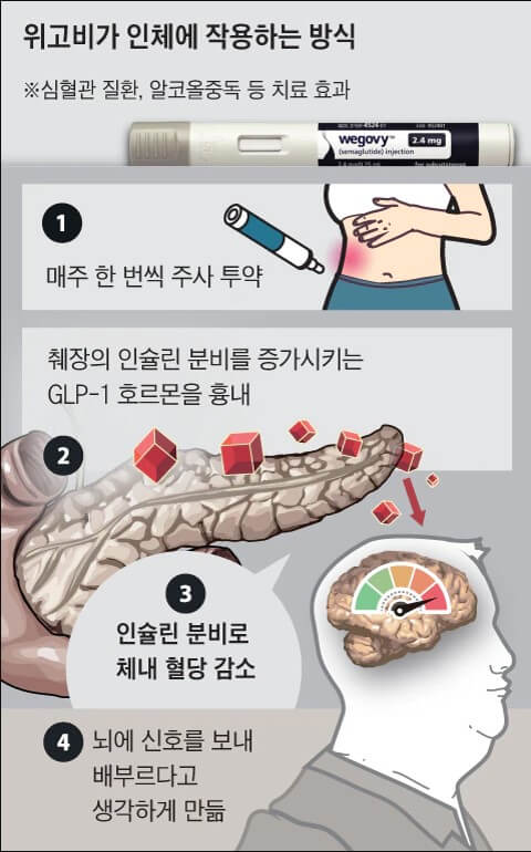 다이어트약 위고비의 부작용