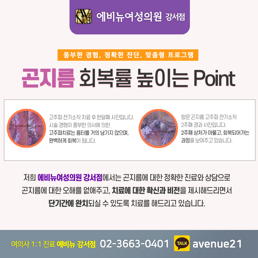 에비뉴여성의원 이미지