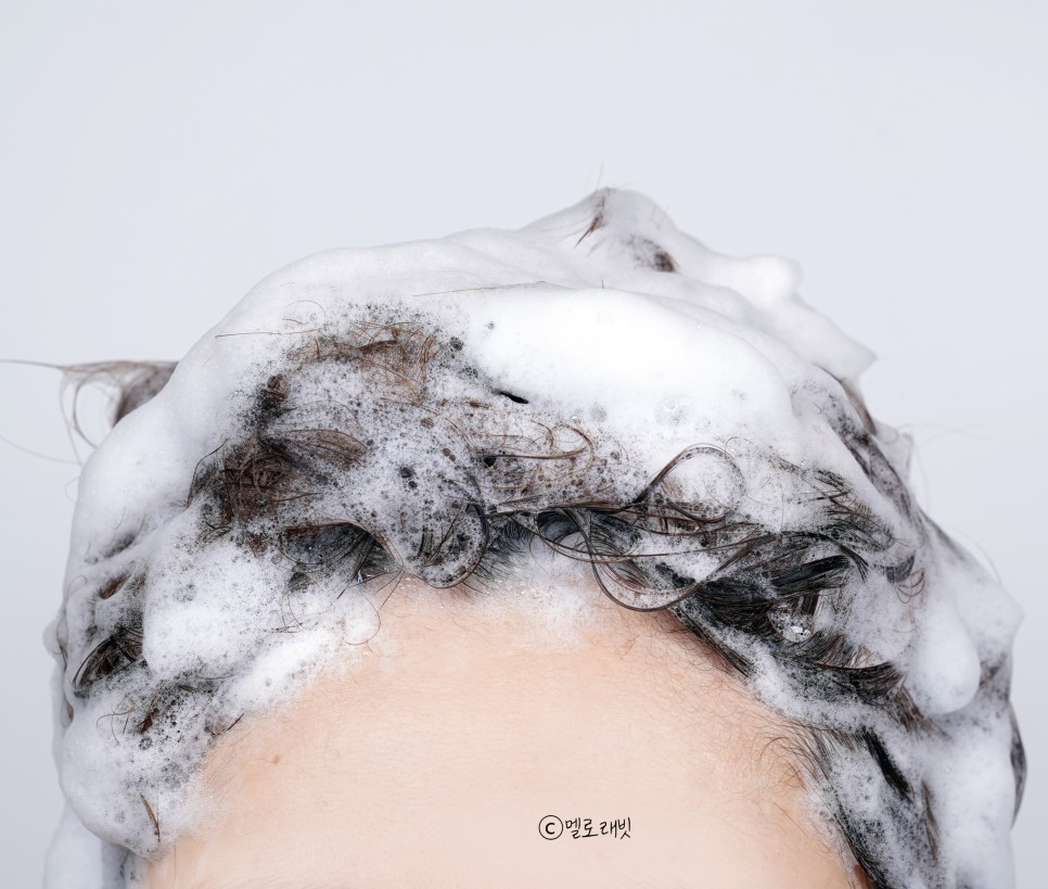 ts 탈모샴푸 이번엔 16