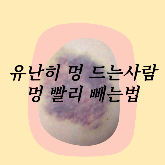 멍 빨리 빼는법