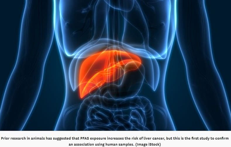 영원한 화학 물질(PFAS)&quot;&#44; 간암 위험 높여...최초 연구 발표..대책은 VIDEO: PFAS: &quot;Synthetic “forever chemical” linked to liver cancer