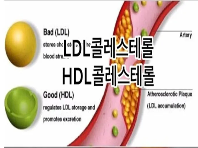 중성지방 낮추는 방법