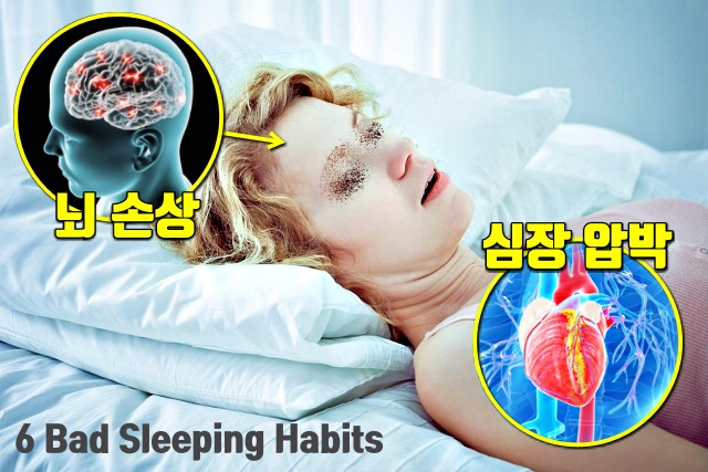 수면무호흡증 증세 자가진단, 양압기, 수면 습관, 건강