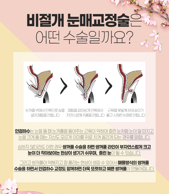 선명 이미지
