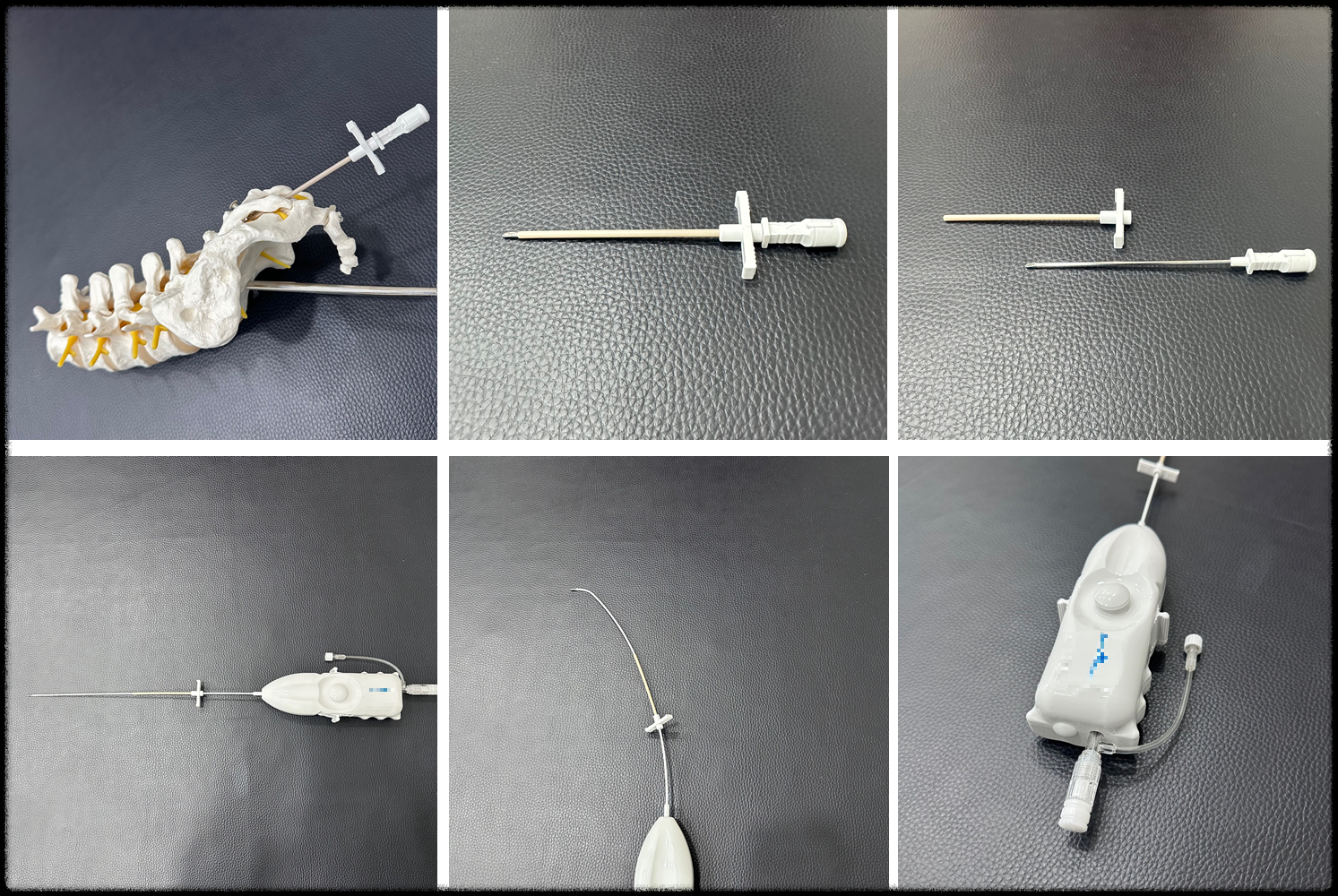 신경 성형술 navi catheter