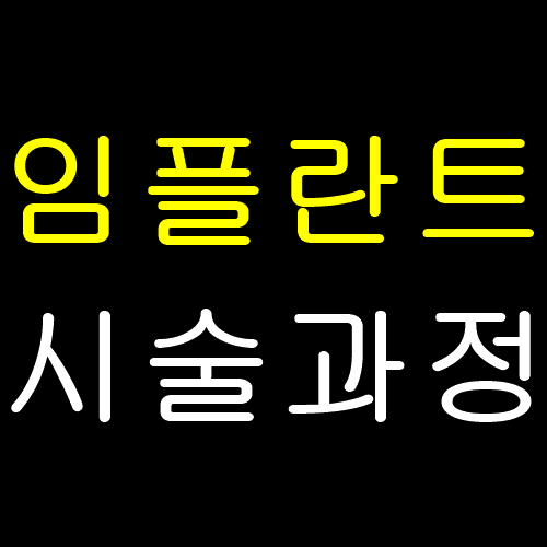  임플란트 시술과정 확인