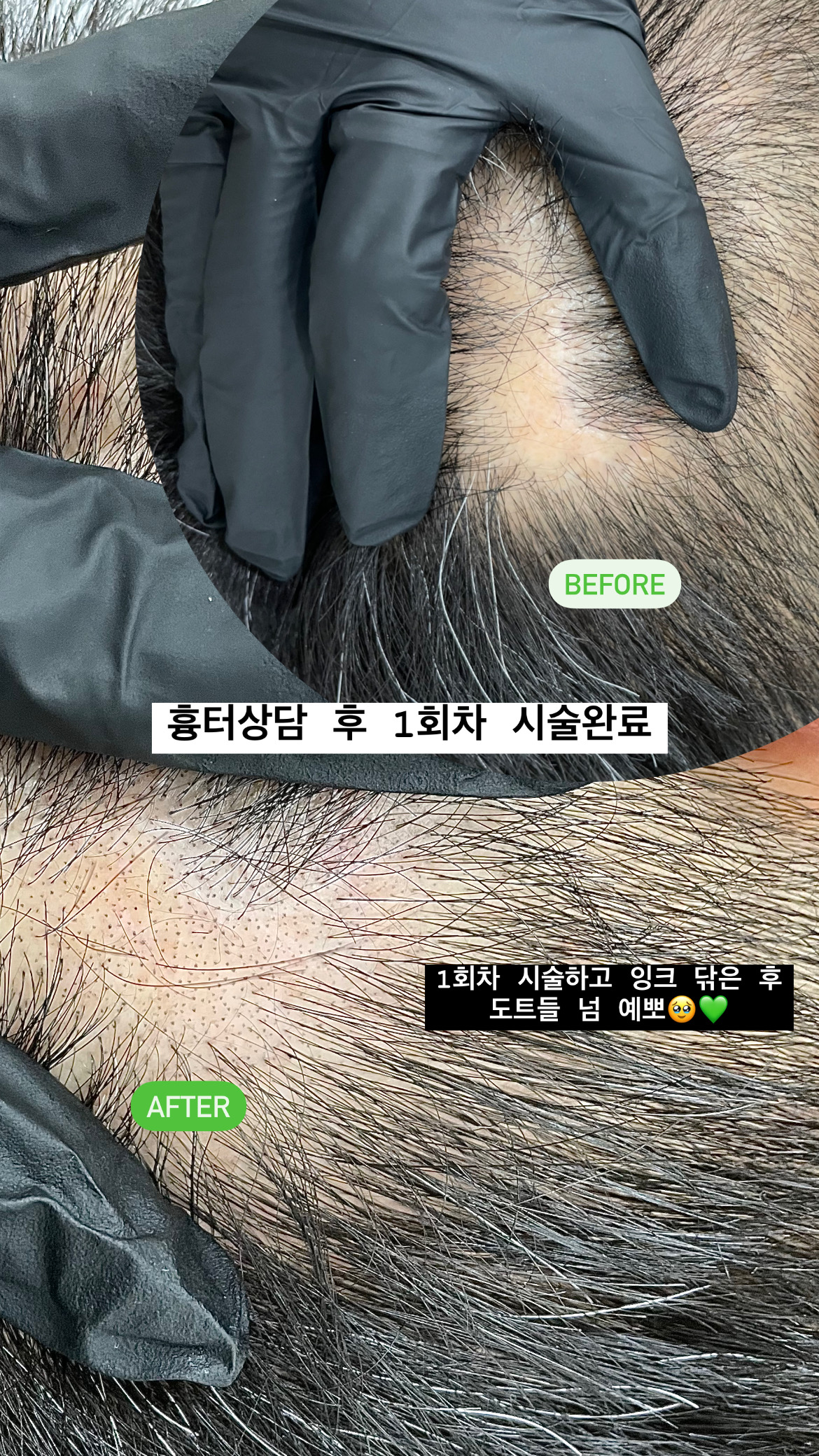 림스칼프 이미지