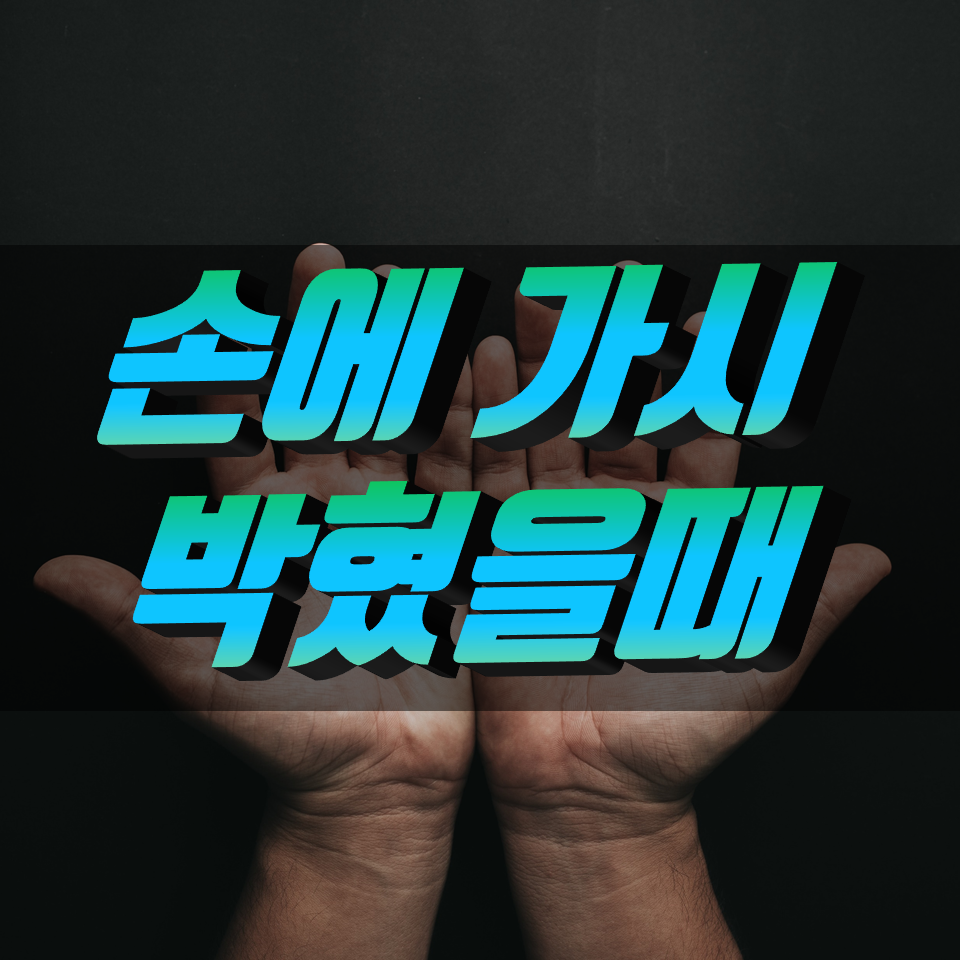  손에 가시 박혔을때 가시 빼는법 간단해요