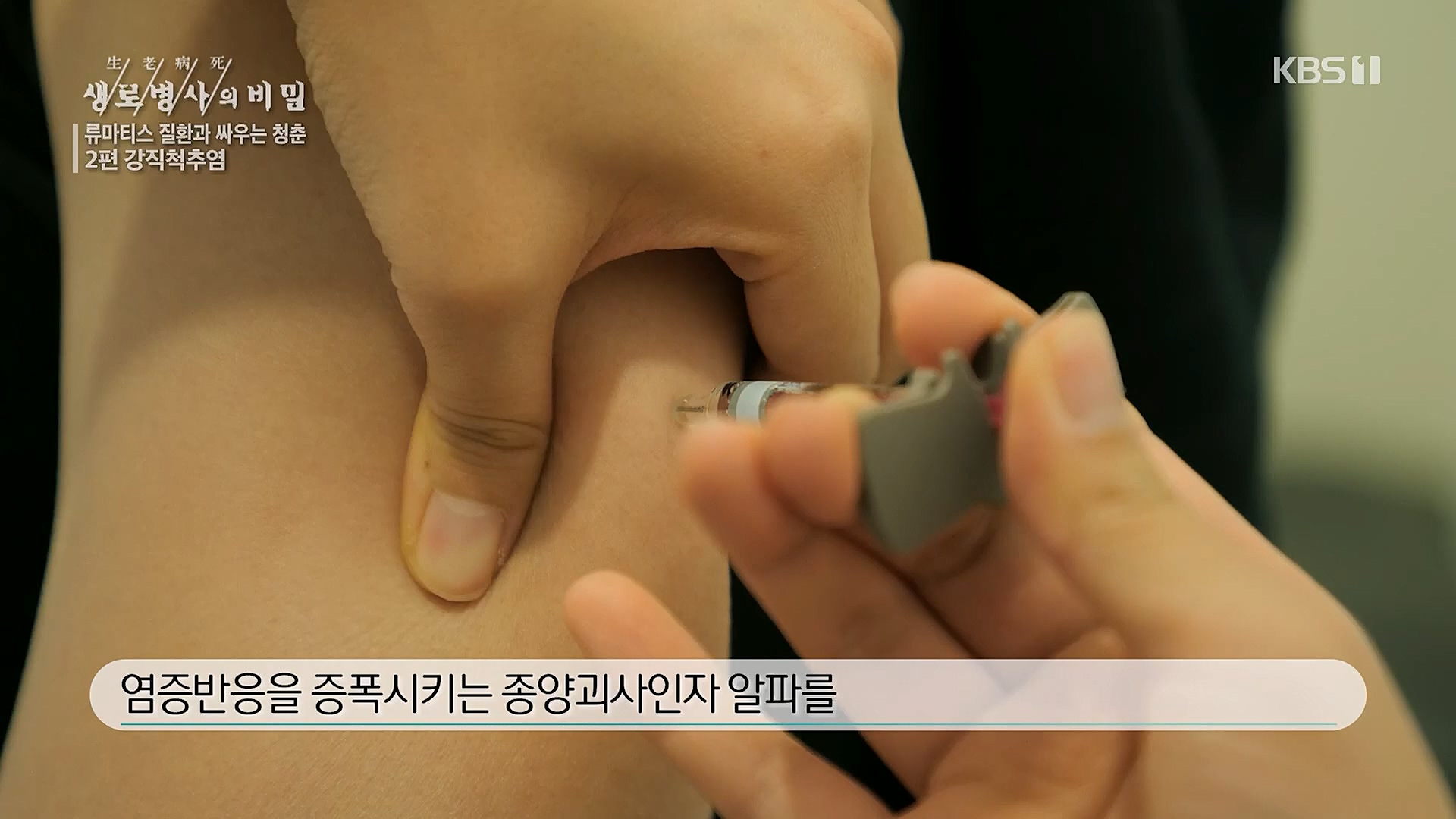 생로병사의 비밀.E861.230322p.H264-F1RST.mp4_20230323_204415.741.jpg