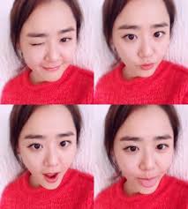 문근영 급성구획증후군 완치