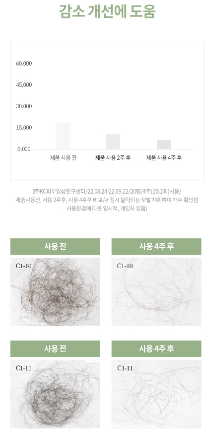 탈락모발수70%감소