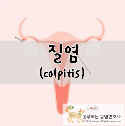 질염(colpitis) 원인, 증상, 치료