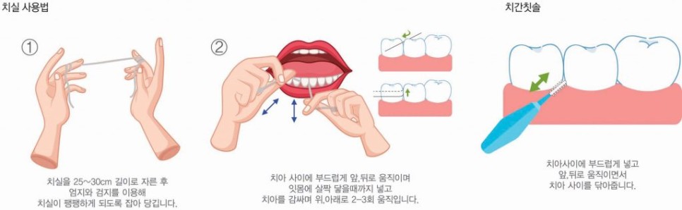  치실 사용법