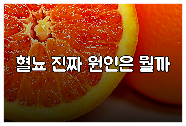 혈뇨 진짜 원인은 뭘까