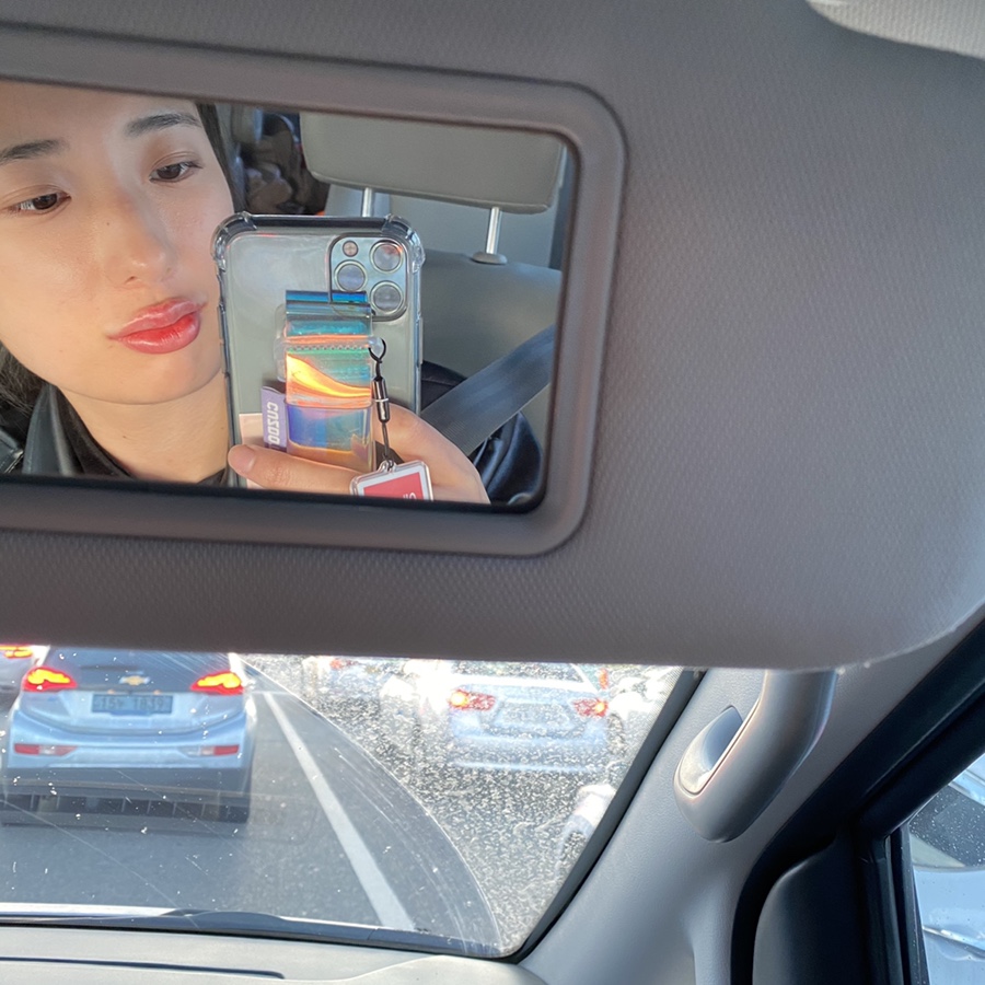 입술 보톡스 부작용 대전 입술필러+입꼬리보톡스 내돈내산 4