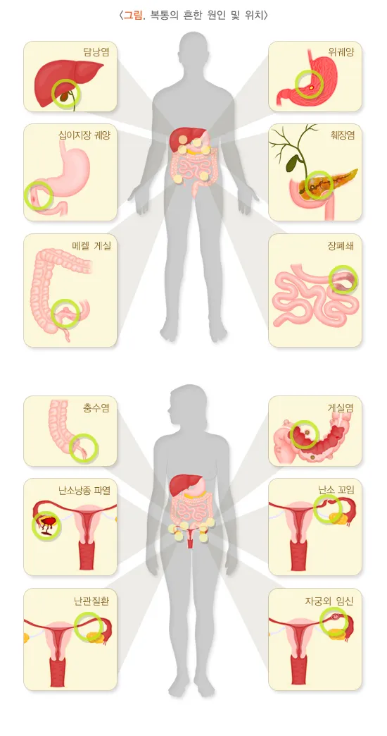 왼쪽 아랫배 통증 움질일때 콕콕 땡김_1