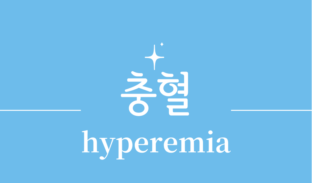 '충혈(hyperemia)'