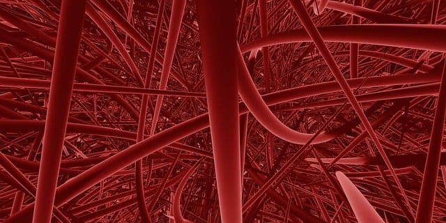 고지혈증 우리 몸의 혈관들이 엉켜있는 모습
