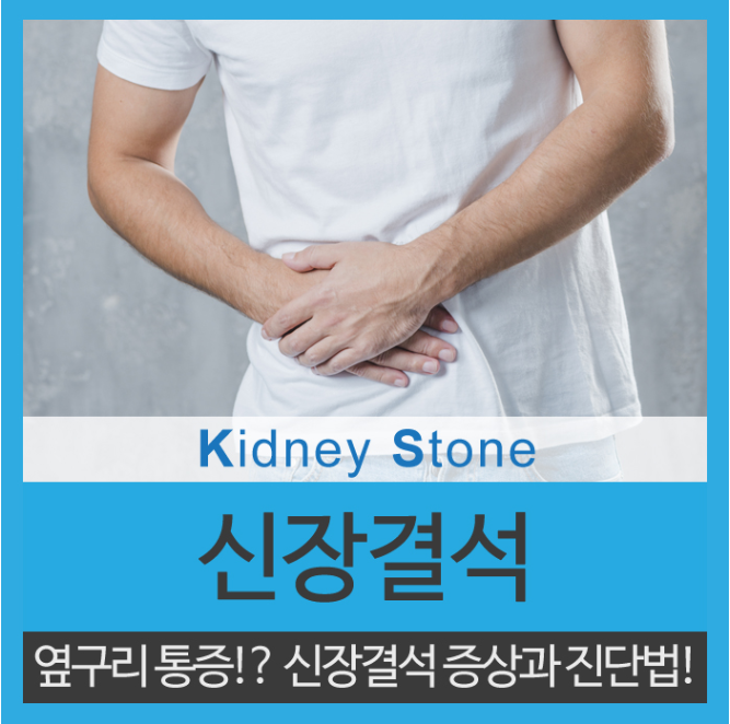  신장결석증상, 오른쪽 옆구리 통증