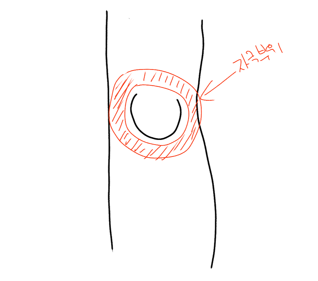 무릎 발목 관절통, 근육통이 있는 사람은 꼭 필독!!! 하세요! ( 발락 저주파 전기 마사지기기) 무릎 발목 관절통, 근육통이 있는 사람은 꼭 필독!!! 하세요! ( 발락 저주파 전기 마사지기기)