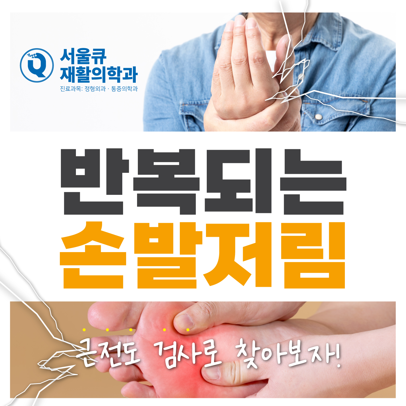  송파사거리정형외과, 반복되는 손 발 저림 어떤 검사와 치료를 받아야 하나?