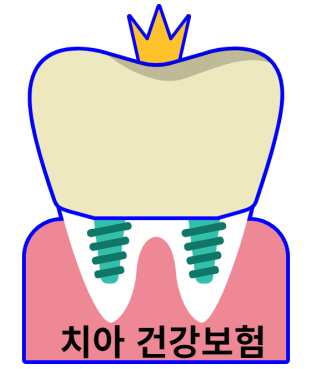 치아건강보험