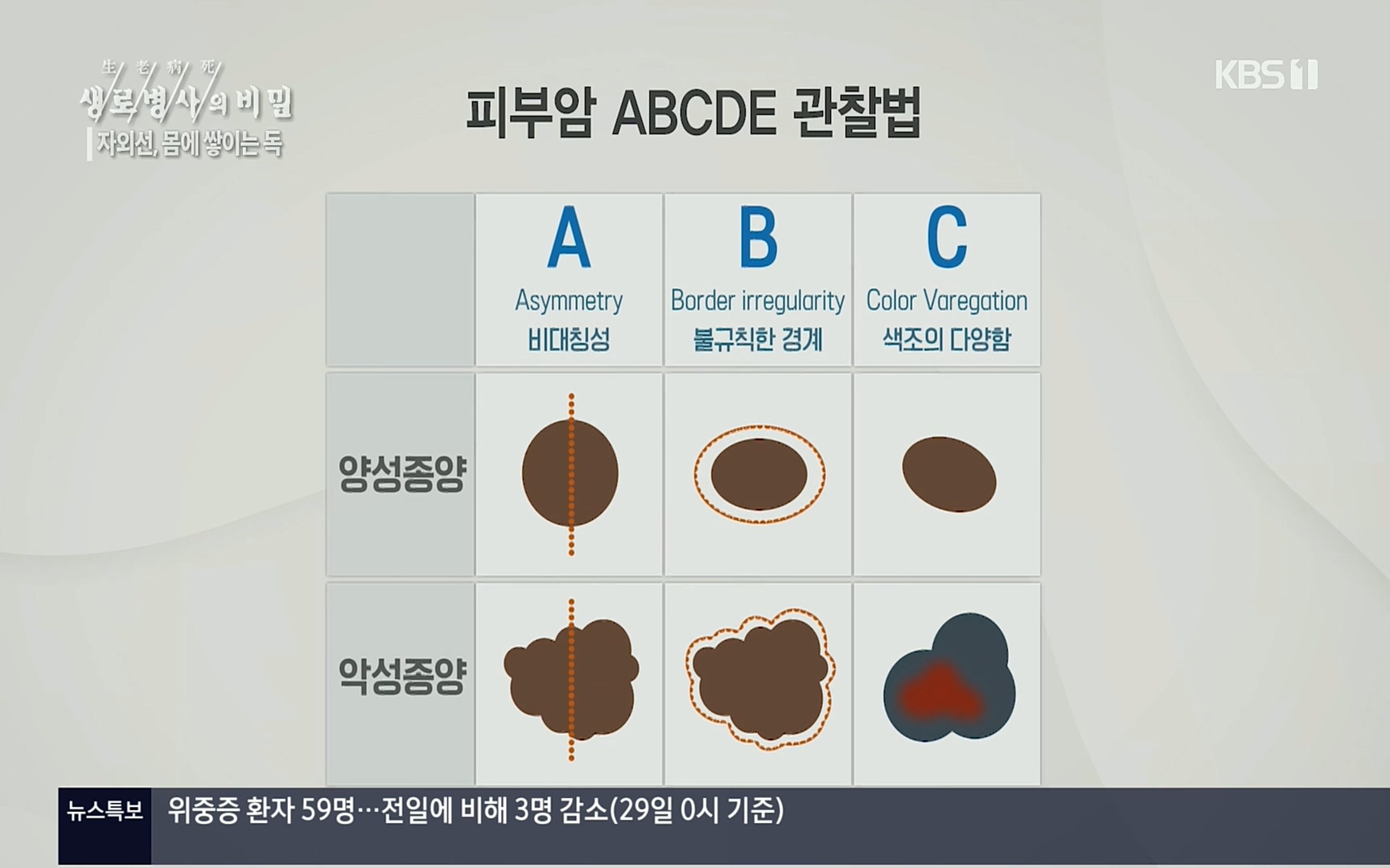 생로병사의 비밀.E824.220629p.H264-F1RST.mp4_20220630_205907.168.jpg