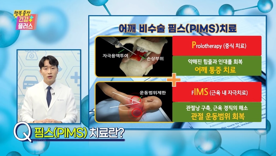 어깨충돌증후군 증상, 원인 및 치료방법