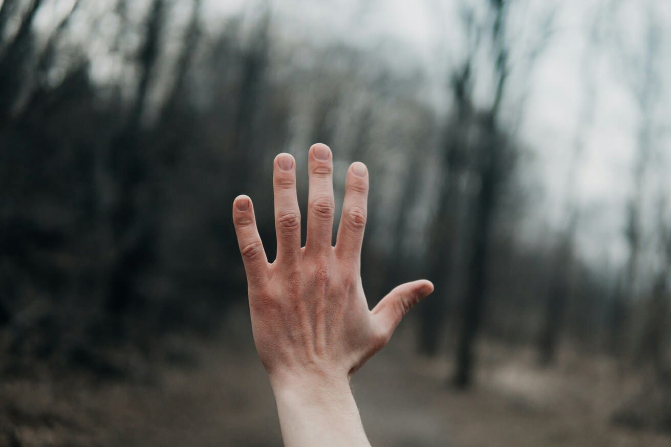 손톱에 세로줄 원인과 관리법