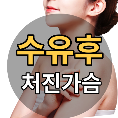 수유후처진가슴