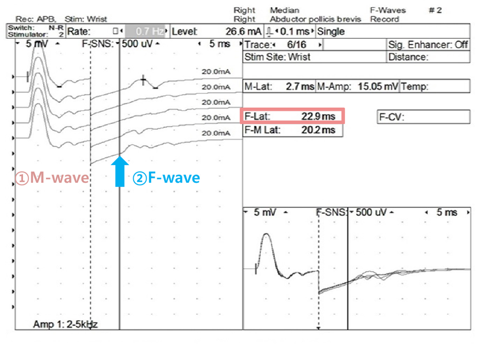Late response 후기반응