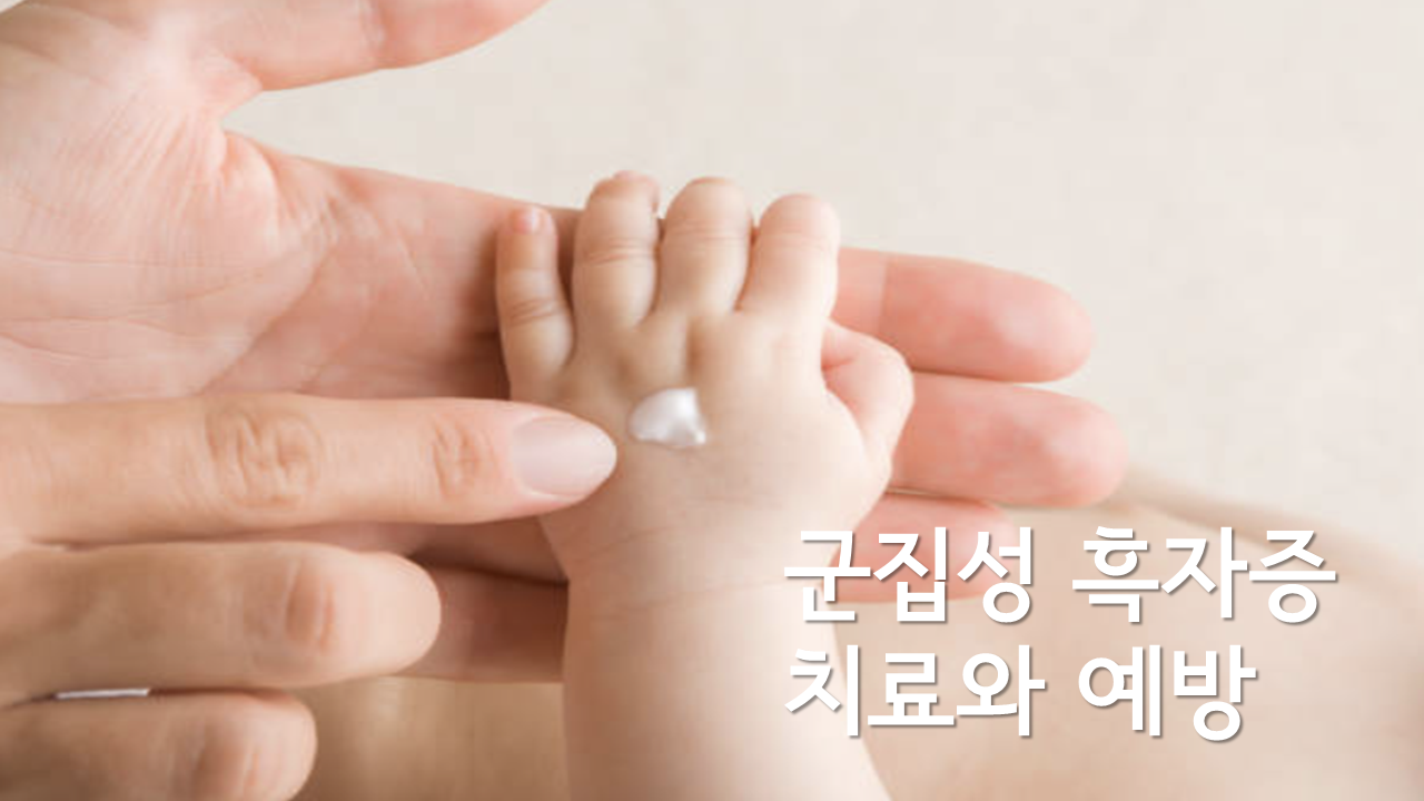 군집성 흑자증 (Agminated lentigenous nevus) 군집성 흑자증 (Agminated Lentigenous Nevus)