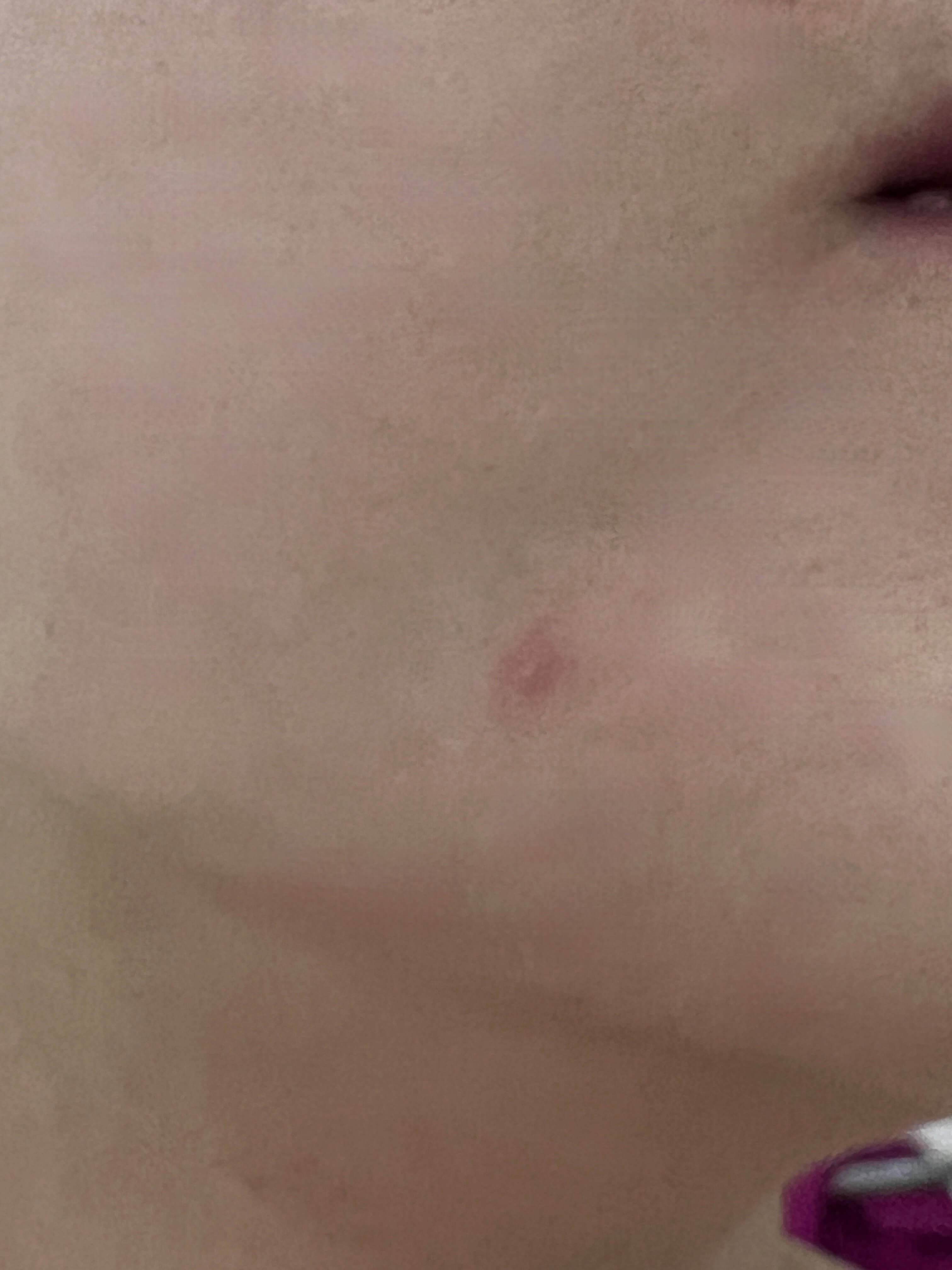 퇴근후패치뗀입가