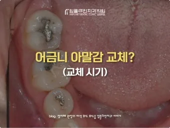 어금니 칫솔 사용법 선택방법 실사용 후기_6