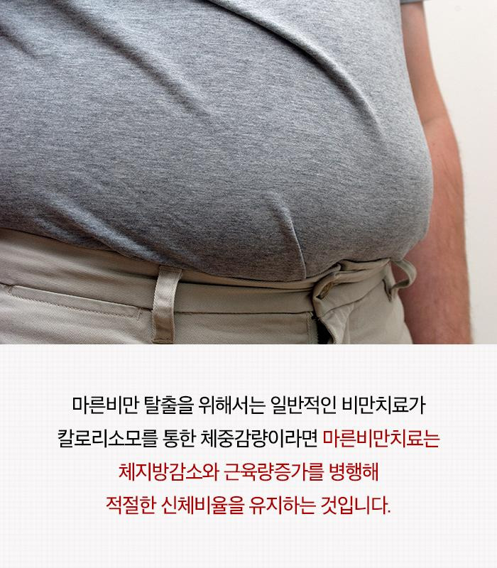 마른비만