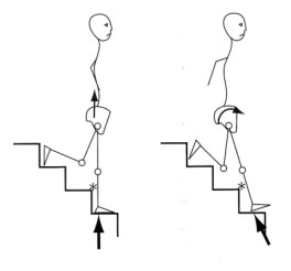 계단을 내려갈 때 발에 전해지는 충격으로 인해서 골반의 업슬립과 전방회전이 일어나는 것을 나타내는 그림
