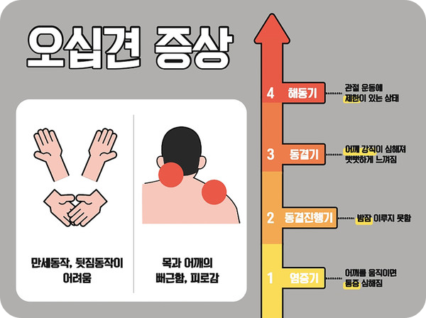 오십견수술비용4