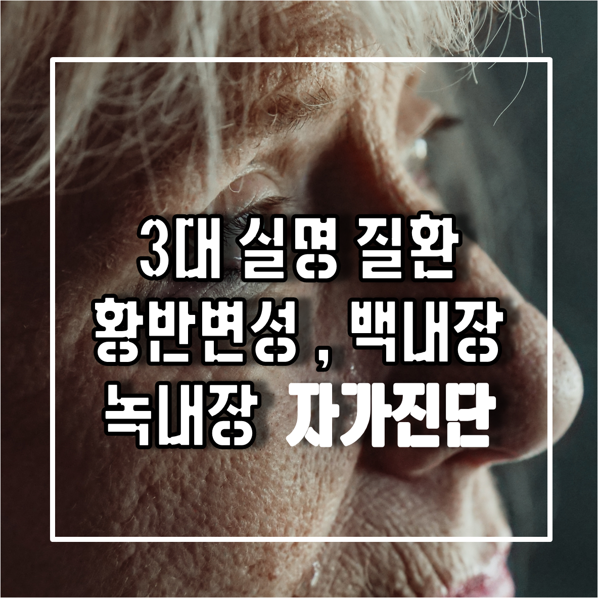 3대 실명 질환