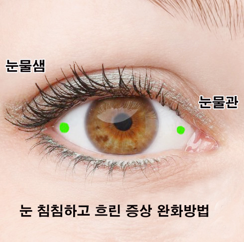 안약 넣는법 인공눈물 큐티스 