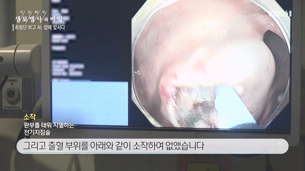 생로병사의 비밀.E881.230831p-NEXT.mp4_20230901_223246.587.jpg