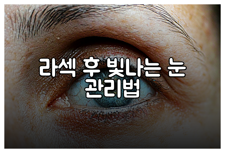 라섹 후 빛나는 눈 관리법