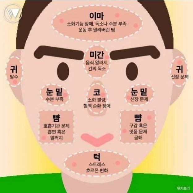  얼굴에 여드름 나는 이유